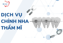 Dịch Vụ Chỉnh Nha Thẩm Mĩ Dịch Vụ Chỉnh Nha Thẩm Mĩ