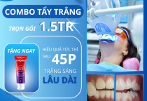 Tẩy Trắng Răng Không Ê Buốt – Ưu Đãi Đặc Biệt Tại Nha Khoa Ninh Kiều Cần Thơ