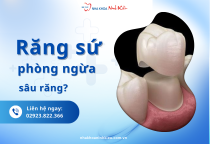 Răng sứ là gì? Giải đáp các vấn đề thường gặp khi bọc răng sứ