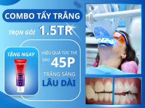 Tẩy Trắng Răng Không Ê Buốt – Ưu Đãi Đặc Biệt Tại Nha Khoa Ninh Kiều Cần Thơ