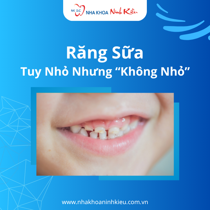 Răng sữa