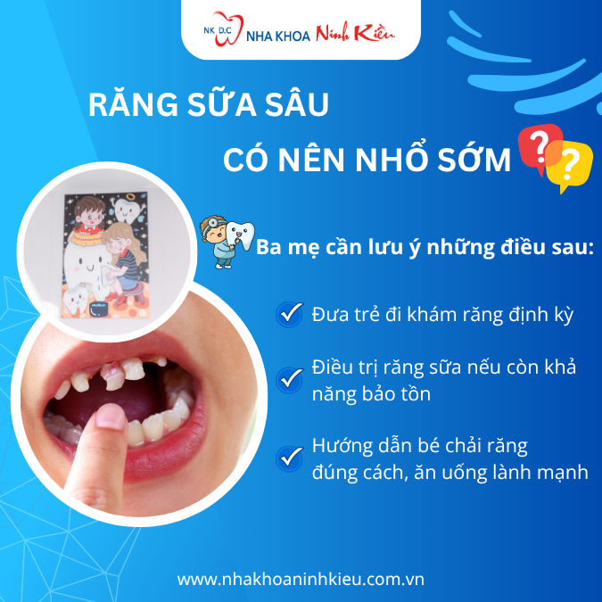 Răng sữa